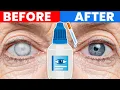 Ultimate Support for Your Cataracts