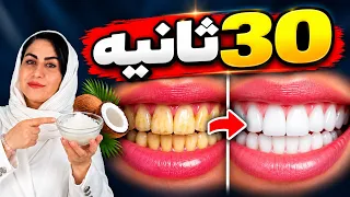 دندونات زرد شده وجرم گرفته ؟این ترکیب ساده رو امتحان کن