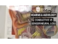 What is the Difference Between Conductive and Sensorineural Hearing Loss - SLUCare logy
