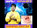 Download Lagu सपने में दांत टूटना, हिलना, गिरना, घिसना, उखड़ना देखना मतलब ? सपने में दांत टूटना शुभ या अशुभ