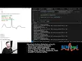 Building an ECG Analysis Bot Coding Fuzzy Logic and Algorithmic Challenges