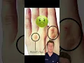 Download Lagu Russell’s sign associated with self induced vomiting…#shorts #doctor #medical #mentalhealth