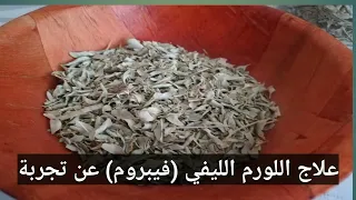 علاج اللورم الليفي فيبروم عن تجربة بالاعشاب عن تجربة امي 