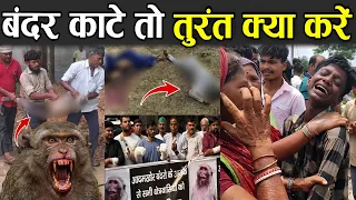 बंदर काटे तो तुरंत क्या करें? | What Happens If a Monkey Bites You