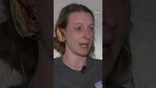 Loose pet monkey attacks woman ripping handfuls of hair and part of her ear off