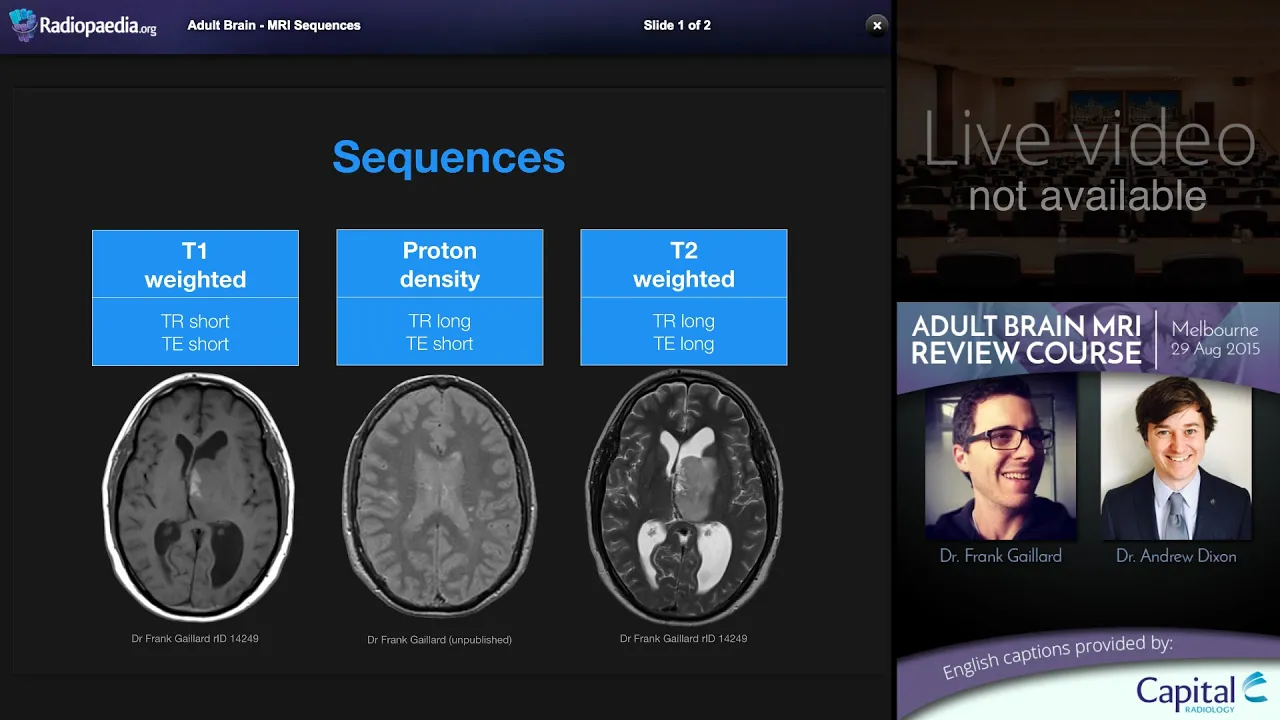 In this video, Dr. Douglas Gillard explains the basics of how to read your lumbar MRI. You will lear. 