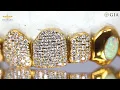 CUSTOM GRILLS FROM DAYYANI JEWELERS