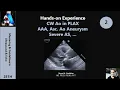 Download Lagu Hands-on Experience 2: CW Ao in PLAX, AAA, Asc. Ao AneurysmSevere AS, …