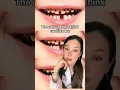 What a cavity actually looks like