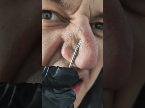 FACEMITES UNDER A MICROSCOPE