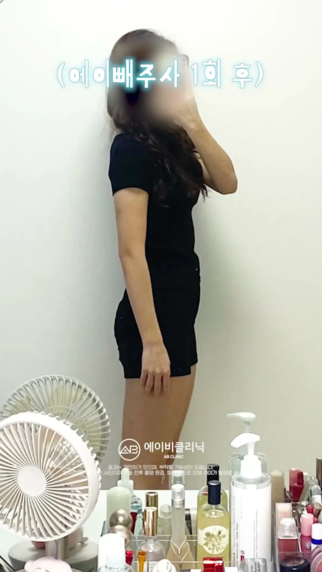 바디 에이빼주사 후 변화는?