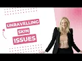 Unraveling Skin Issues High Histamine Levels and Eczema Hives Rosacea Acne Itchy Skin and More