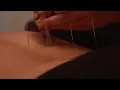 ACUPUNCTURE in MELBOURNE FL
