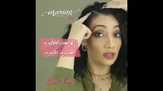 علاج القشرة بوصفة فعالة جدا دندنها