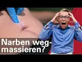 Download Lagu Wenn du deine Narbe so massierst, wird sie quasi unsichtbar! (Narbenmassage Anleitung)