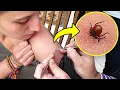 Download Lagu इन 5 जहरीले कीड़े से हमेशा बचकर रहें Most Painful Insect Stings In The World