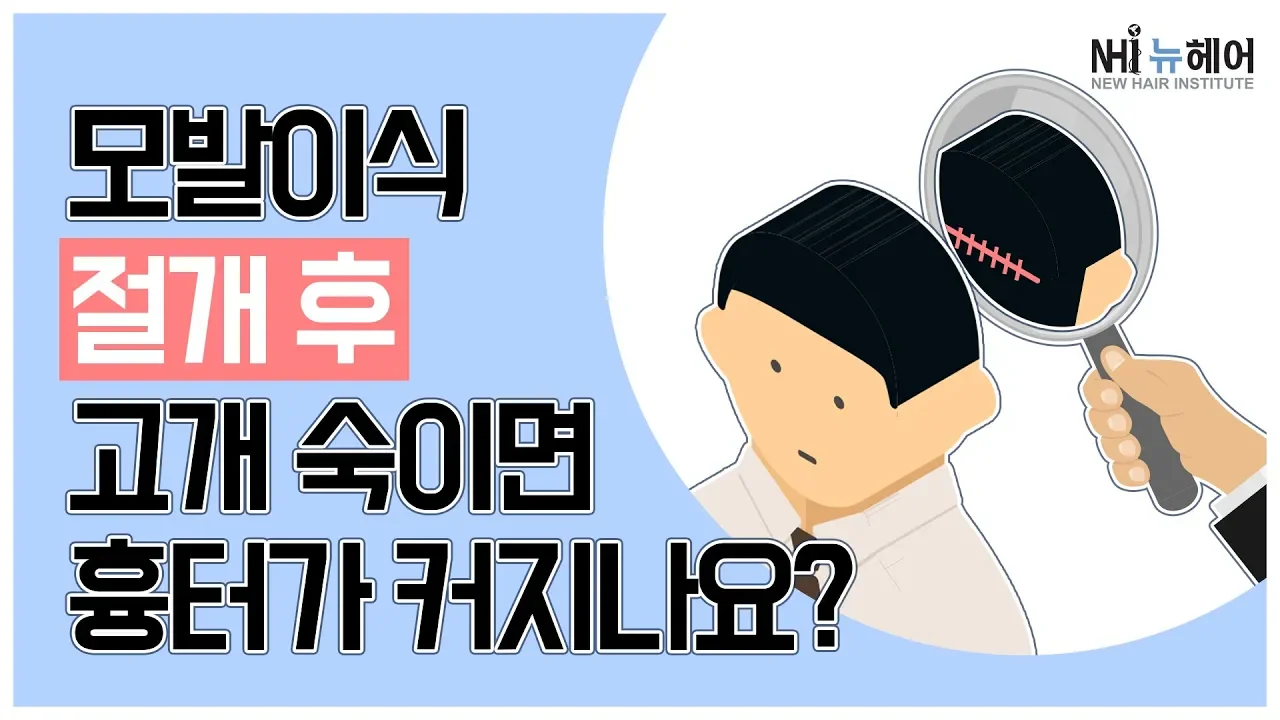 모발이식 절개 후 고개 숙이면 흉터가 커지나요? - 뉴헤어 I 모발이식 I 탈모QnA I [모발이식][모발이식후기]