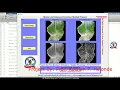 Maize Leaf Disease Detection Using Image Processing With Source Code Maize Leaf Disease Prediction