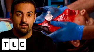 Cyclist Arrives With Her Throat Cut Open! | Untold Stories Of The ER