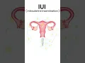Download Lagu IUI Process |  Pravi Test Tube Baby Centre Kanpur