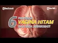 Lagu 6 Penyebab Vagina Hitam, Termasuk Akibat Gesekan