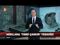 02 06 2016 Atv Haber Erenköy FTR Çamur Tedavisi