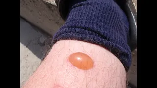 At the Doctors