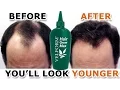 Download Lagu Hair Grow Max