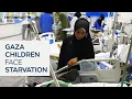 Download Lagu One in five children under five in Gaza City acutely malnourished