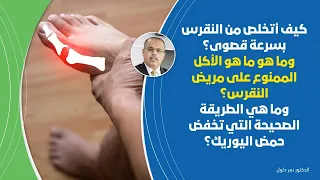 الان ... علاج النقرس النهائي خلال مدة قصيرة  ما لا تعرفه عن اليورك اسيد وكيف تحمي نفسك من أفظع ألم
