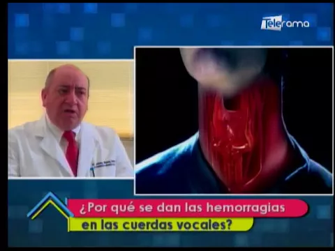 ¿Por qué se dan las hemorragias en las cuerdas vocales?