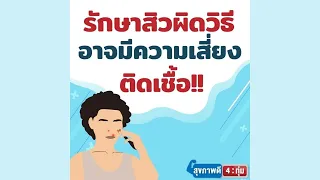 สิวที่เกิดบริเวณจมูกหรือใต้คางเป็นสิวชนิดใด