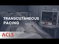 Transcutaneous Pacing ACLS Certification Association