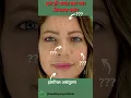 Download Lagu Causes of acne pimples| Pimples hone ke karan| acne on cheeks| acne pimple on forehead #shorts #acne