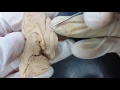 4 Median Sagittal of the Brain 1