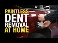 How to Remove Dents from a Car Without Damaging the Paint - Paintless Dent Repair
