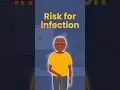Ways to Lower Your Risk of Infection During Cancer