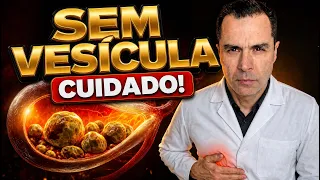 TIROU a VESÍCULA? O que NINGUÉM te avisa depois da cirurgia (cirurgião explica)