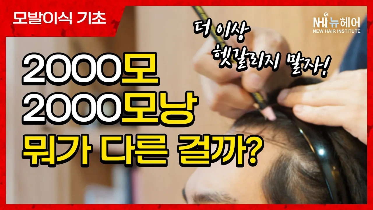 모발이식 병원마다 견적이 달라요! 모와 모낭은 무슨 차이?