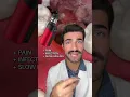 Wisdom Teeth - Vaping Dry Sockets