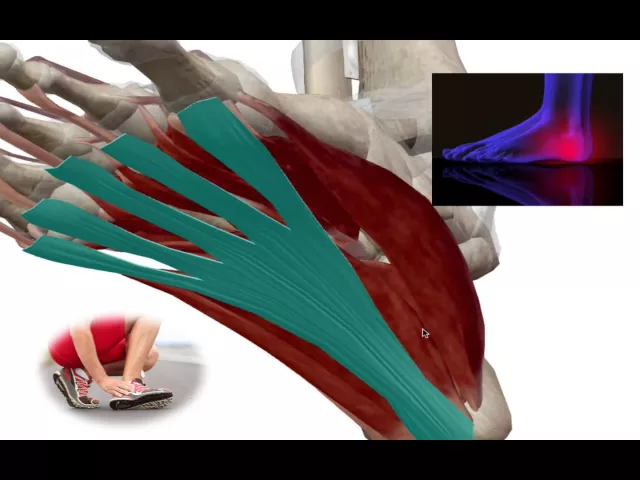 Plantar Fascia