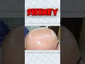 WHY BALD PEOPLE HAVE SHINY HEADS