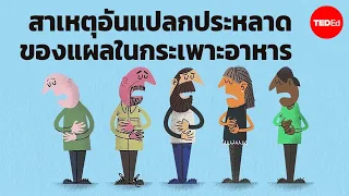  ทำไมการรักษาแผลในกระเพาะอาหารด้วยยาปฏิชีวนะถึงมีประสิทธิภาพ 