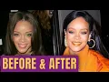 Rihanna on her latest interview tells everyone about her plastic surgery and how important it is