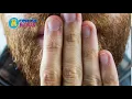 Download Lagu SUARA SENDAWA #BURP  #SENDAWA
