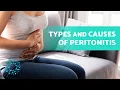 PERITONITIS EXPLAINED Types Causes and Symptoms of this Abdominal Condition