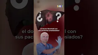 Un cirujano marca los hígados de sus pacientes | Upsocl #shorts