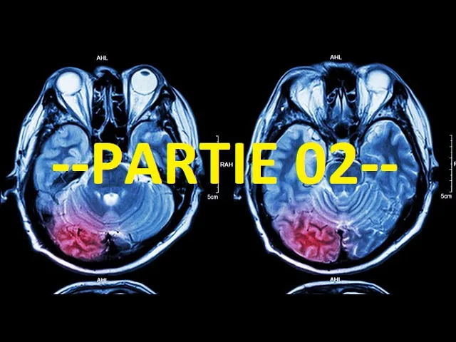 QCMs Neurologie PARTIE 2