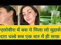 Remove pimples and scars permanently/how to remove pimples  /glowing and clear skin with aloevera