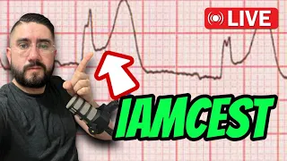 Indicaciones en IAM 🫀| A proposito de un caso